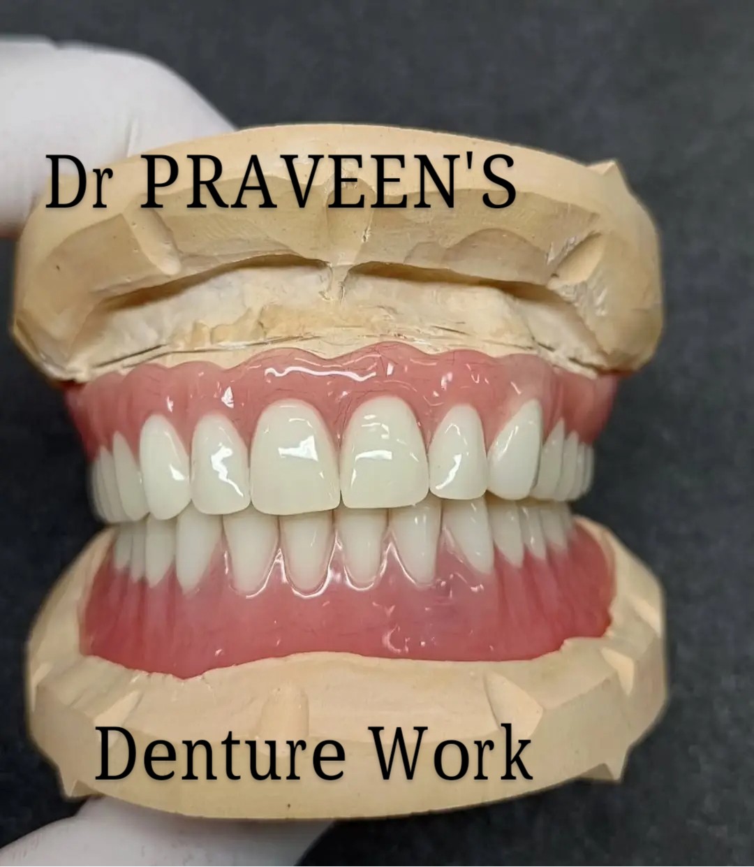 Custom denture fitting